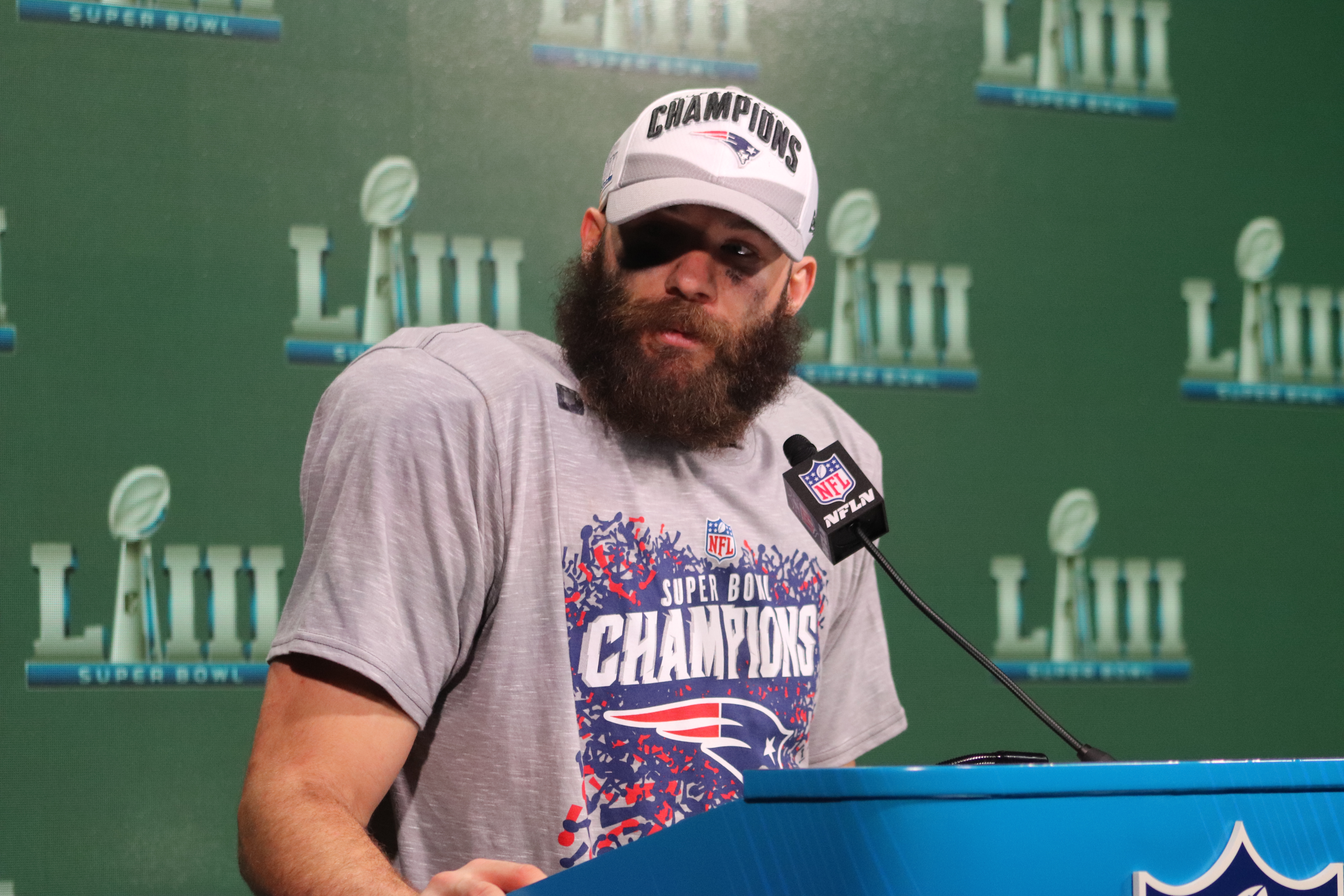 20190203 - Julian Edelman 01